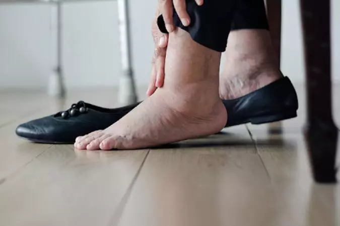 Tràn dịch khớp cổ chân có thể dẫn đến yếu cơ, mất khả năng vận động tại khớp