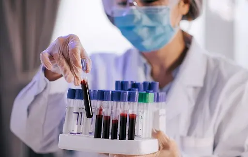 Xét nghiệm RF giúp hỗ trợ phát hiện và đánh giá yếu tố dạng thấp trong máu