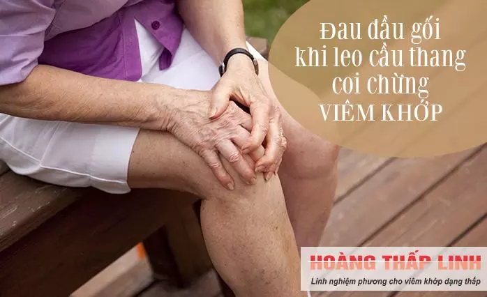 Đau đầu gối khi leo cầu thang - Dấu hiệu SỐ 1 của bệnh viêm khớp mà hầu như chẳng ai quan tâm