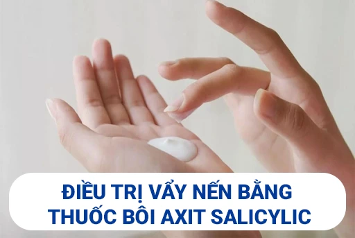 Su-dung-thuoc-boi-ngoai-da-axit-salicylic-cho-benh-vay-nen.webp
