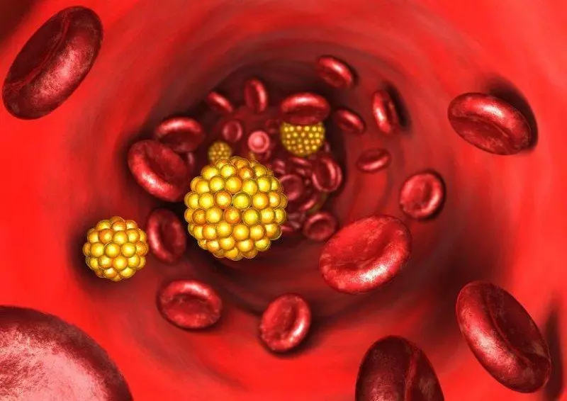 Làm gì khi triglyceride tăng cao?