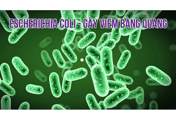 viem-bang-quang-co-nguyen-nhan-chinh-do-vi-khuan-escherichia-coli-gay-ra.webp