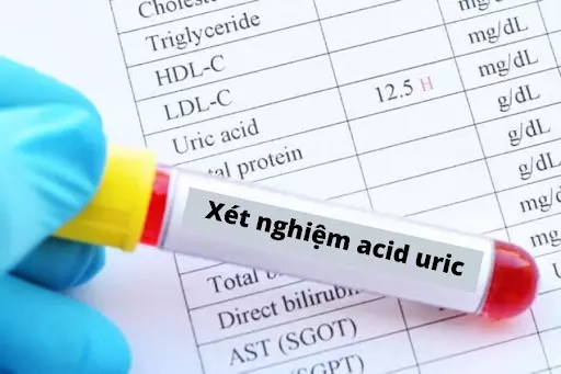 Acid uric cao cảnh báo bệnh gì? Nguyên nhân, cách điều trị 