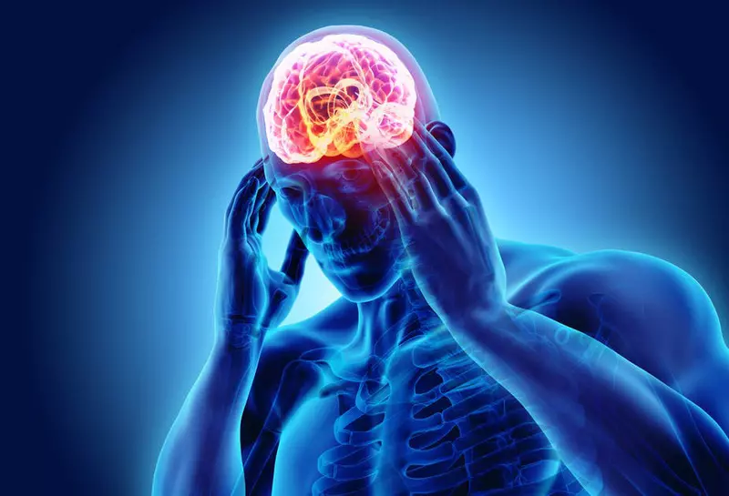 Ung thư phổi giai đoạn cuối di căn não gây đau đầu