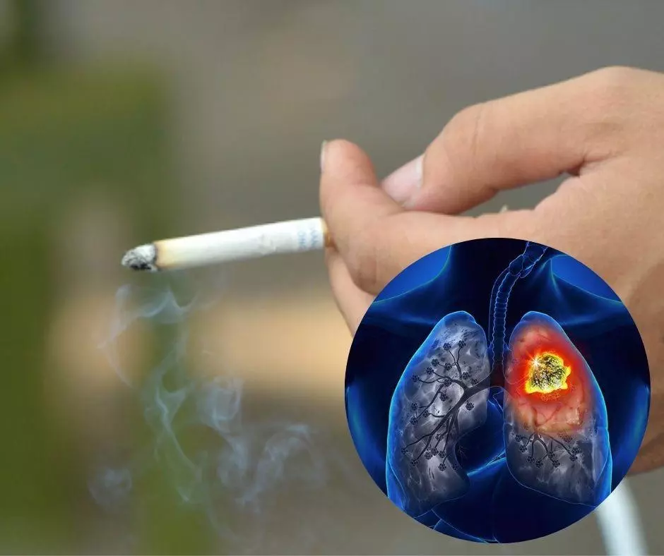 Thuốc lá chứa nhiều chất làm tăng nguy cơ phát triển bệnh ung thư phổi