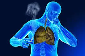 Bệnh lao phổi có chữa khỏi được không? Chuyên gia giải đáp