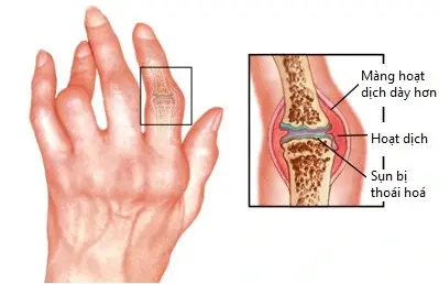 4. Các phương pháp điều trị