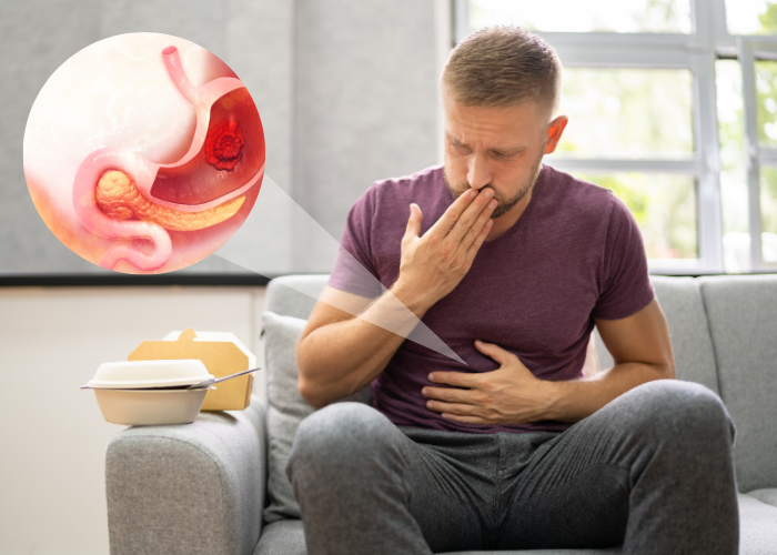 6 Dấu hiệu bệnh đau dạ dày và cách giảm đau tại nhà