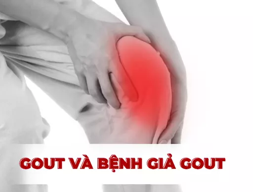 Gout và bệnh giả gout – Phân biệt như thế nào?