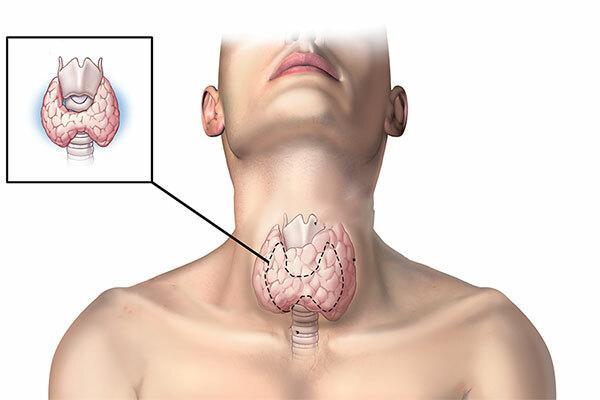 7. Kết luận về u tuyến giáp