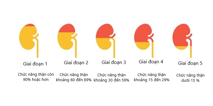 Thuốc điều trị suy thận độ 3: Giải pháp tối ưu cho sức khỏe thận