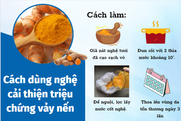 Hoạt chất curcumin ở trong nghệ có tác dụng chống viêm hiệu quả