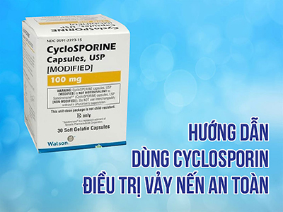 Hướng dẫn sử dụng Cyclosporin an toàn trong điều trị vảy nến  