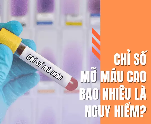 Chỉ số mỡ máu cao bao nhiêu là nguy hiểm? Chuyên gia giải đáp