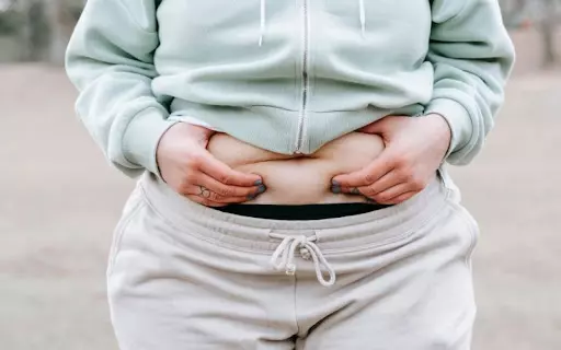 Những vấn đề nên biết về béo phì và cách kiểm soát cân nặng
