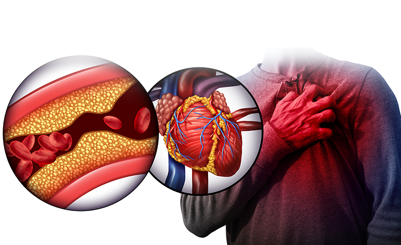 Hiểm họa khôn lường của máu nhiễm mỡ và giải pháp phòng tránh hiệu quả