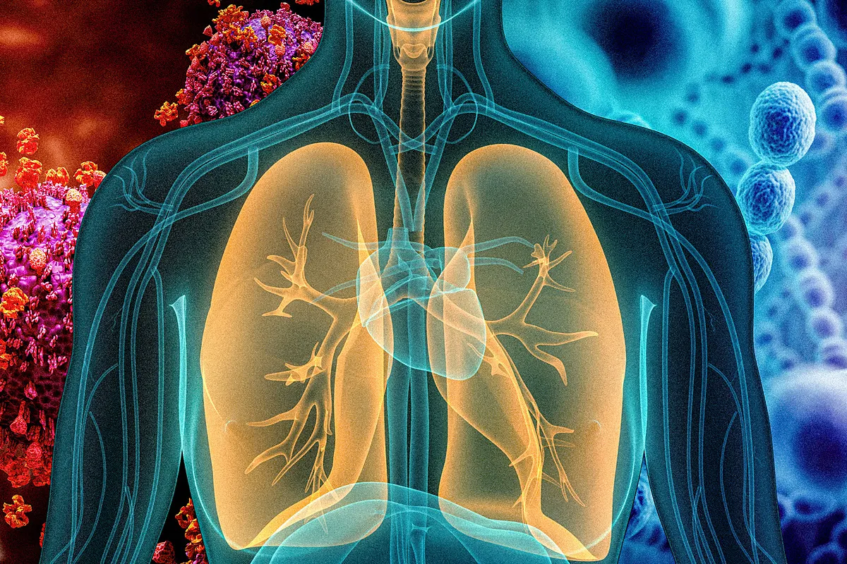 Bị viêm phổi bao lâu thì khỏi? [Chuyên gia giải đáp]