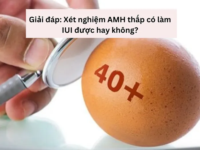 Giải đáp: Xét nghiệm AMH thấp có làm IUI được hay không?