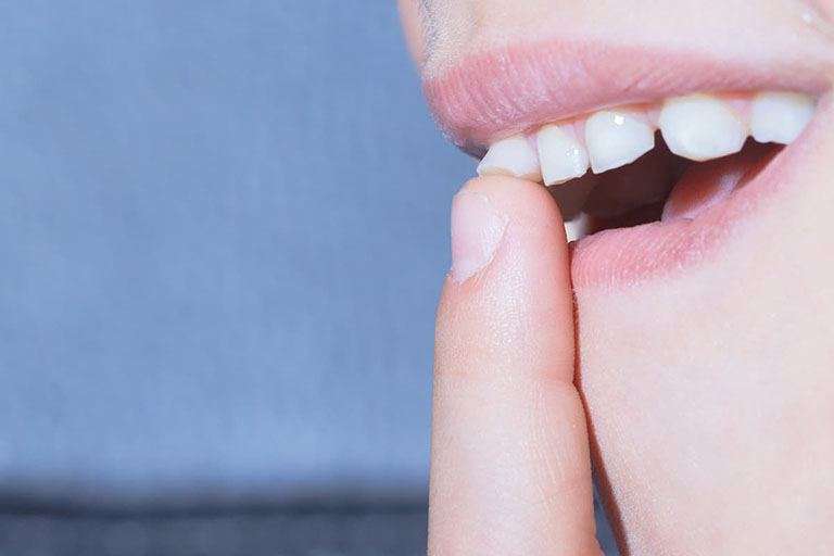 Phương pháp điều trị răng bị lung lay luôn hướng đến là bảo tồn răng