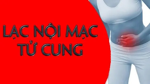 Thuốc Mới Điều Trị Lạc Nội Mạc Tử Cung: Cập Nhật Hiệu Quả Và Lựa Chọn Phù Hợp