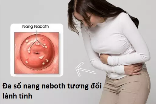 da-so-nang-naboth-tuong-doi-lanh-tinh.webp
