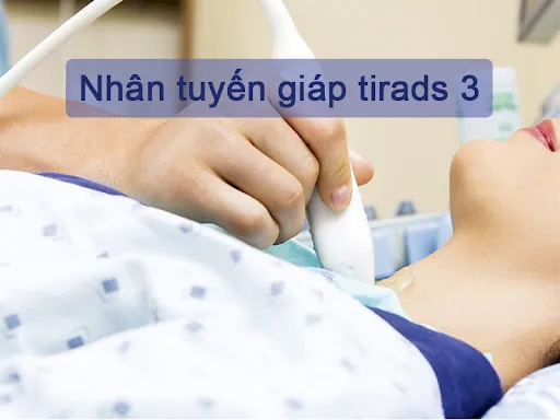 Nhan-tuyen-giap-tirads-3-la-thuat-ngu-chuyen-dung-trong-sieu-am-chan-doan.webp