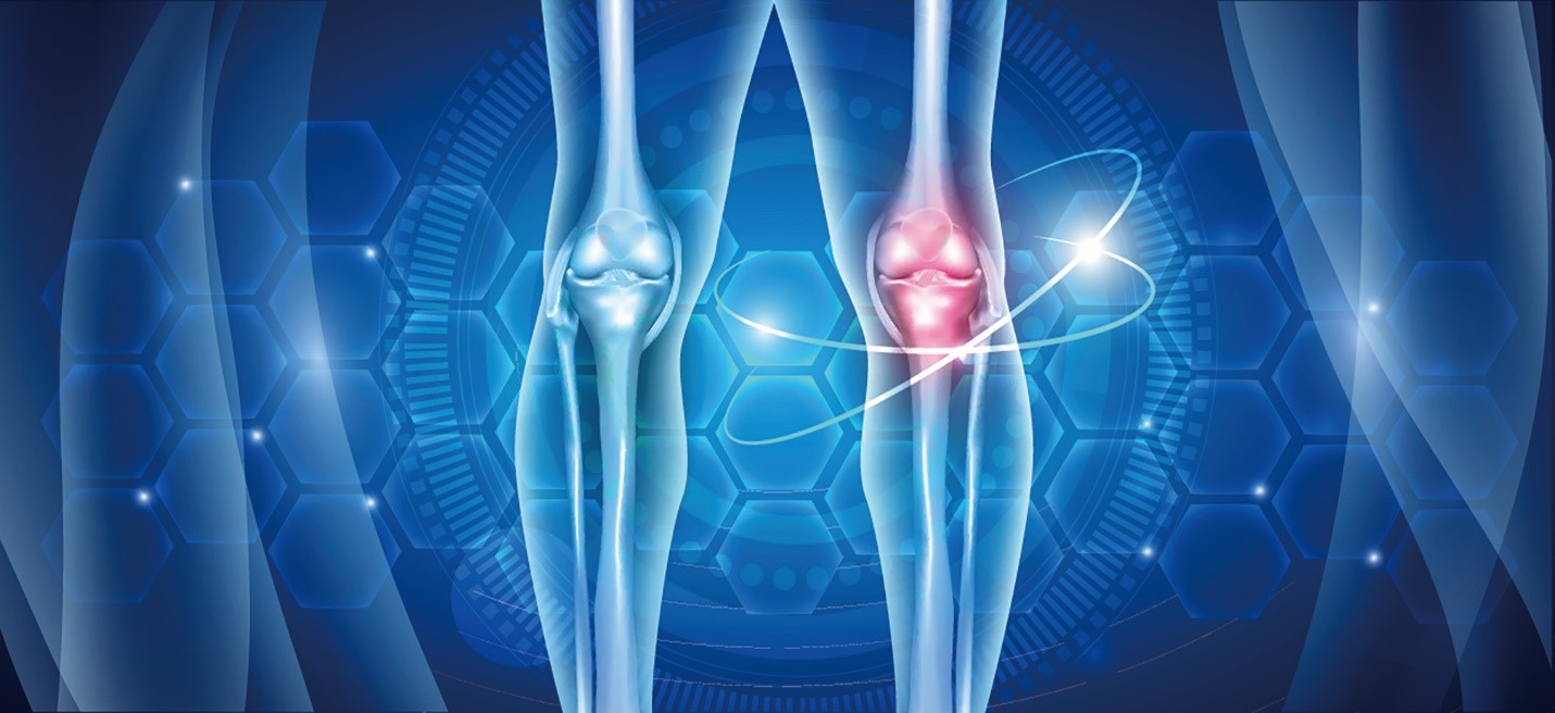 Bổ sung collagen có giúp giảm đau xương khớp không?