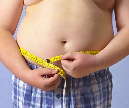 Trẻ béo phì có nguy cơ bị viêm khớp cao hơn