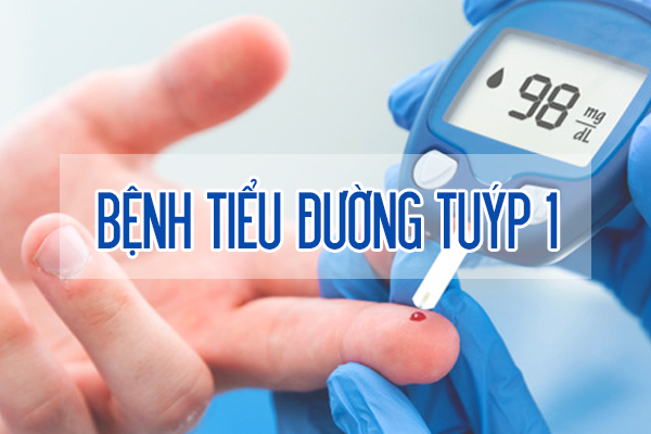 6. Những yếu tố ảnh hưởng đến chỉ số tiểu đường tuýp 1