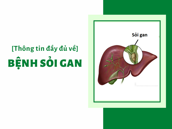 7. Chế Độ Ăn và Phòng Ngừa Sỏi Gan