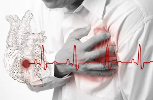 Tìm hiểu biến chứng của rối loạn nhịp tim, cách phòng ngừa và điều trị