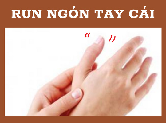 Bệnh Run Ngón Tay Cái: Nguyên Nhân, Triệu Chứng và Phương Pháp Điều Trị Hiệu Quả