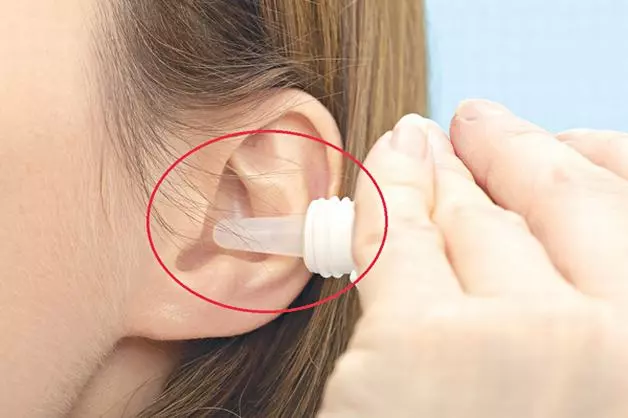 Kháng sinh dạng thuốc nhỏ tai thường được dùng để điều trị viêm màng nhĩ