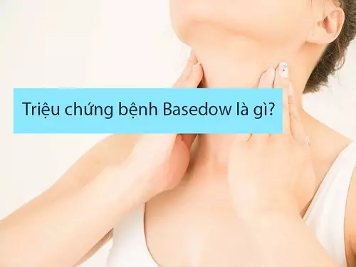 Cảnh báo triệu chứng bệnh Basedow và cách điều trị dứt điểm