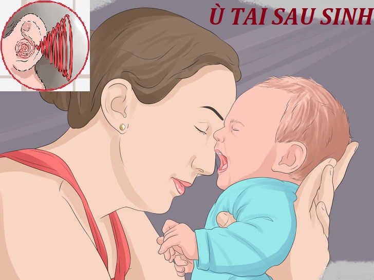 Ù tai sau sinh gây ảnh hưởng lớn cho cả mẹ và bé