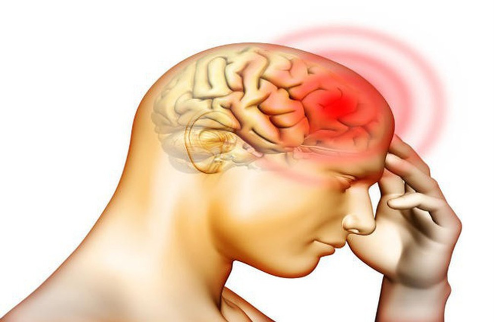 Choáng váng – Biểu hiện của tai biến mạch máu não