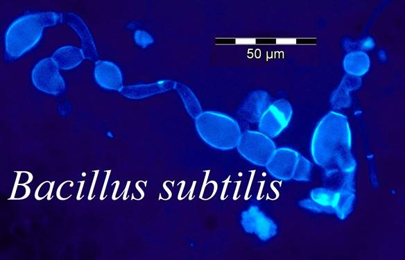  Lợi khuẩn bacillus subtilis giúp cải thiện tình trạng loạn khuẩn đường ruột