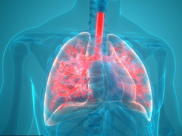  Viêm phế quản dạng hen có thể dẫn đến viêm phổi