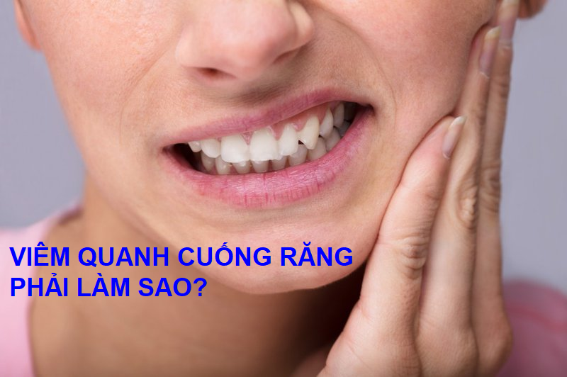   Viêm quanh cuống răng khiến người mắc đau nhức
