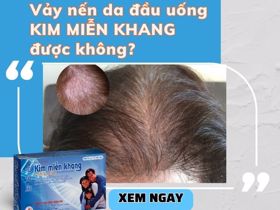 Bị vảy nến da đầu uống Kim Miễn Khang được không?