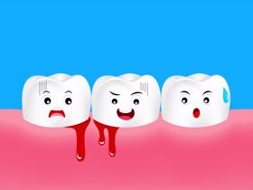 Chảy máu chân răng là thiếu chất gì và khắc phục bằng cách nào?