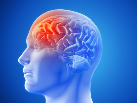 Làm sao để ngăn chặn đột quỵ não tái phát?