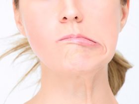 Người bệnh méo miệng sau đột quỵ nên luyện tập như thế nào?