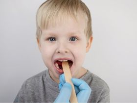 Có nên nạo VA cho trẻ Khi bị viêm VA hay không?