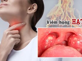 Dấu hiệu nhận biết viêm họng hạt và phân biệt với ung thư vòm họng