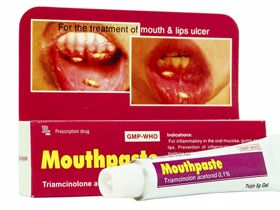 Thuốc Mouthpaste trị nhiệt miệng và vấn đề cần lưu ý khi dùng 