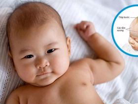 Trẻ sơ sinh bị thiếu vitamin D3 - Làm sao để nhận biết?