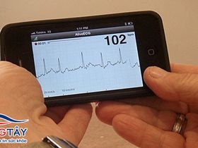 Phát hiện rối loạn nhịp tim bằng ứng dụng mới trên điện thoại
