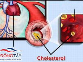 Thuốc làm giảm cholesterol máu ở người đái tháo đường
