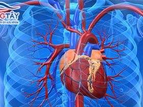 Nhồi máu cơ tim: ai có nguy cơ cao?